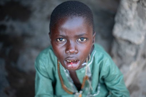 Niger State ARC-P: Bridging the Healthcare Gap for Vulnerable Children Abubakar Sadiq Mustapha